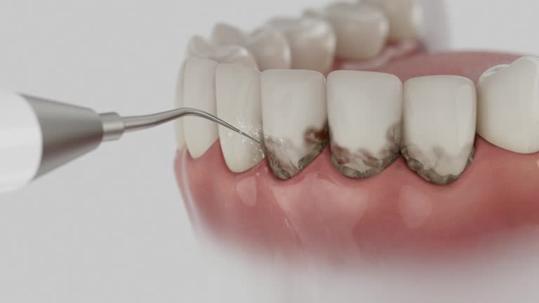 Reliable Tooth Extraction contractor in Burke, VA by Smile Center Dentistry